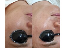 バリューネクスト 青葉台/◆ダクトピール◆LHAが進化版