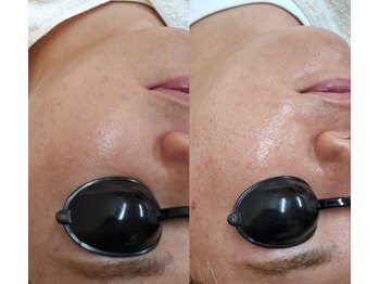 バリューネクスト 青葉台/◆ダクトピール◆LHAが進化版