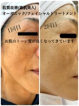 ブルーム(B.LOOM)/フィトフェイシャル