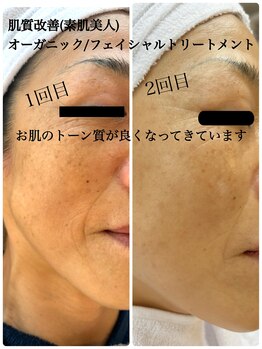 ブルーム(B.LOOM)/フィトフェイシャル