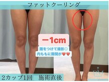 リメイク 広尾(REMAKE)/