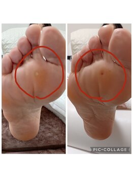 遊歩堂/真ん中魚の目