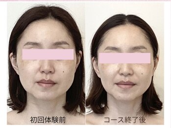 幸せ甦顔/別人級の小顔美人！