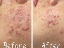 シャルム ココ 八尾店(Charme coco)