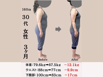 穴田鍼灸整骨院/【３０代　女性】ダイエット