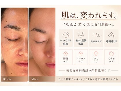 アールヨンマルハチ フェイスアンドアイ(R408.face&eye)の写真