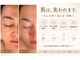 アールヨンマルハチ フェイスアンドアイ(R408.face&eye)の写真