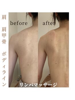 ビアージュ ナガクテ(Beage nagakute)/当店自慢のリンパマッサージ