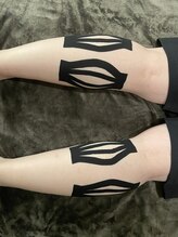 アイリー(Irie)/筋膜テーピング