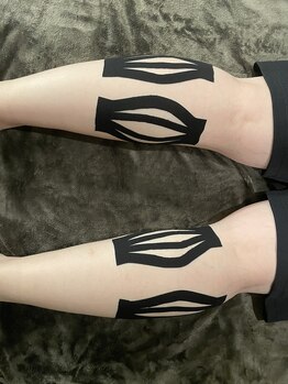 アイリー(Irie)/筋膜テーピング