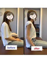 ドクターズリゾート(Dr's Resort:)/腰部構造調整例