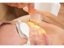 メディカルサロン フィオレ(fiore)/光パワーライトフェイシャル