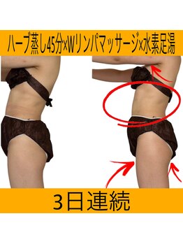 ヨサパーク マナ(YOSA PARK MANA)/ハーブ蒸し【1週間に3回】(痩身)