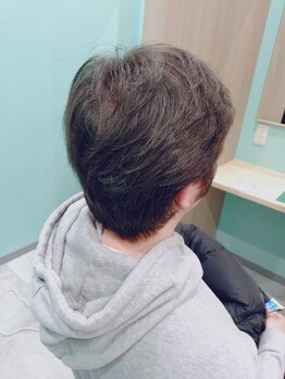 ヘッドスパ 町田店/ヘッドスパ