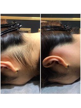 ルミライズ(Lumirise)/うなじワックス/うなじ