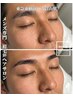 【人気No.1】第一印象アップコース 眉毛/毛穴洗浄スキンケア