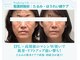 ドアディ(Doordie)の写真/NEW!!【IPLリフト×高周波BTX】たるみ・ほうれい線が気になる!Wマシン使いで、肌育成×小顔リフトアップ!