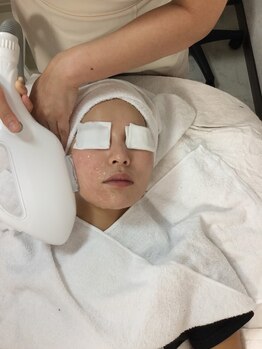 クピド(Cupid)/フェイス脱毛