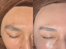 ルーナジェーナ(Luna llena)/池袋/目白/雑司ヶ谷/エステ