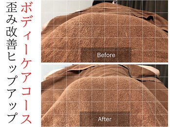 スナリ(SUNARI)/ヒップケア Before→After