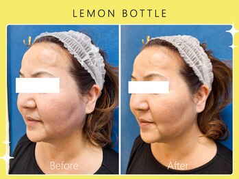 シロカネ 光の森店(SHIROKANE)/レモンボトル☆