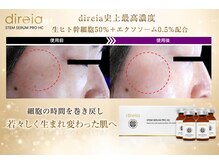 たるみ・小顔 肌育専門看護師サロン CLINICAL SALON Rinの雰囲気(エレクトロポレーションで生ヒト幹細胞導入で肌を生き返らせます)