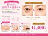 【切らないクマ取り】目の下の凸凹クマ改善ケア サーマルRF+フォーカスオン