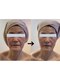 ルミナ ビューティーアンドリラックス(LUMINA Beauty&Relax)の写真/《効果を実感!二重アゴ・たるみにアプローチ!!》マスクなしでも自信が持てる上向き小顔&理想のツヤ肌へ♪
