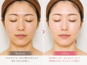 トータルヘルスビューティーカズ(TotalHealthBeauty KAZU)の写真/40代以降の肌悩みを光美容の力でまとめてケア♪ハリツヤ不足・たるみ・ほうれい線が気になる方へ◎