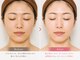 トータルヘルスビューティーカズ(TotalHealthBeauty KAZU)の写真/40代以降の肌悩みを光美容の力でまとめてケア♪ハリツヤ不足・たるみ・ほうれい線が気になる方へ◎
