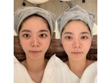 ポーラ ザ ビューティ アピタ千代田橋店(POLA THE BEAUTY)/20代前半ののお客様にも人気♪