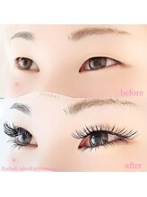 クルミナージュ(Kuruminaaje)/6～8Dボリュームつけ放題上下