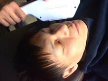 ノーブル(NOBLE)/ひげ脱毛　施術風景（３）