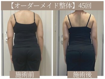 ドクターボディ 恵比寿店(Dr.Body)/【肩こり/首こり/頭痛/だるさ】