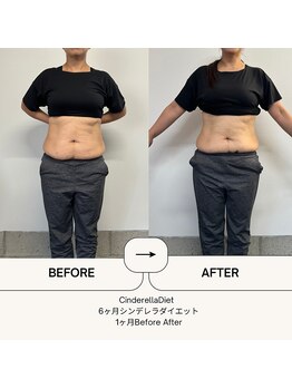 オーシャン整骨院(OCEAN整骨院)/6ヶ月コース