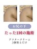 【ローマピンク】お尻色素+美尻エステ23.5万円→13.2万円★美尻エステが無料
