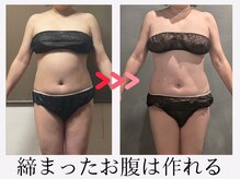 ツーアップ(2up)/お腹のくびれ