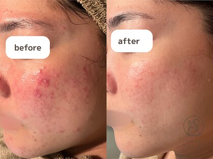 サンゴ(Sango)の写真