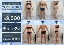 シュシュ(CHUCHU)