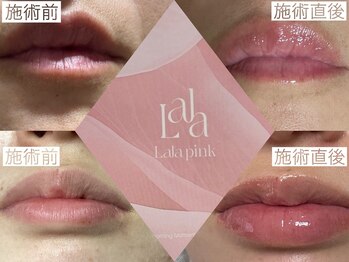 ココラッシュ(coco.lash)/LALAPINK