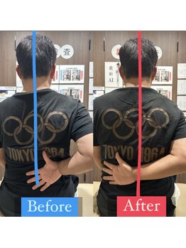 ナオル整体 宮崎院(NAORU整体)/40代男性施術事例【肩痛改善】