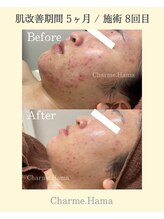シャルム(Charme.)/オーダーメイドフェイシャル