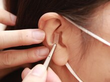 スマイルカイロプラクティック/耳ツボ痩身法