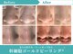 リメイクビューティークリニック(REMAKE BEAUTY CLINIC)の写真