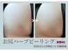 【2回目以降のご来店】お尻ハーブピーリング│2種のハーブから選べる¥22000