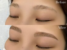 ニコ(Nico)/hollywood brow lift