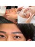 美眉Wax＋パーツ脱毛＋肌質改善Wax