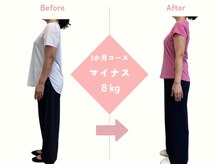 ひがし出来町接骨院/骨盤矯正/整体/ダイエット