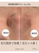 ラ リリー ステラ(La Lily stella)/毛穴洗浄の効果！