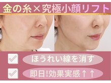 ムーンライズ(moonrise)